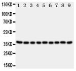 Kallikrein 10 Polyclonal Antibody