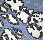 Kallikrein 2 Polyclonal Antibody