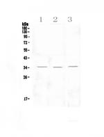 NKG2D (CD314) Polyclonal Antibody