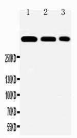 Laminin alpha-2 Polyclonal Antibody