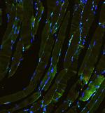 Laminin gamma-1,2,3 Antibody in Immunohistochemistry (Paraffin) (IHC (P))