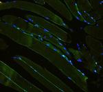 Laminin gamma-1,2,3 Antibody in Immunohistochemistry (Paraffin) (IHC (P))