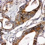 Laminin gamma-1 Polyclonal Antibody