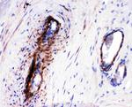 LASP1 Antibody in Immunohistochemistry (Paraffin) (IHC (P))