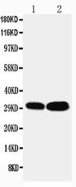 LASP1 Antibody in Western Blot (WB)