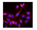 LCK Polyclonal Antibody