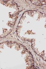 LCN1 Polyclonal Antibody