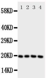 LCN1 Antibody in Western Blot (WB)