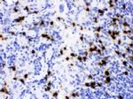 NGAL Polyclonal Antibody