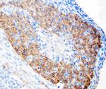 LHR Polyclonal Antibody