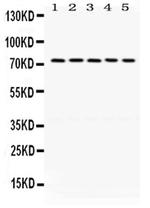 LIMK1 Polyclonal Antibody