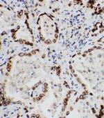 Lamin A/C Polyclonal Antibody