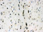 LUM Polyclonal Antibody
