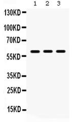 LUM Antibody in Western Blot (WB)