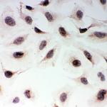 MAD1 Antibody in Immunocytochemistry (ICC/IF)