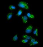 MAOA Polyclonal Antibody