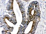 MAOA Antibody in Immunohistochemistry (Paraffin) (IHC (P))