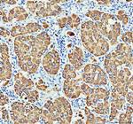 MAOB Antibody in Immunohistochemistry (Paraffin) (IHC (P))
