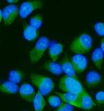 MKK7 Polyclonal Antibody