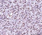 MKK7 Antibody in Immunohistochemistry (Paraffin) (IHC (P))