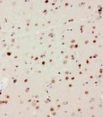 MEKK3 Antibody in Immunohistochemistry (Paraffin) (IHC (P))