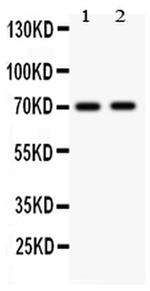 MEKK3 Antibody in Western Blot (WB)