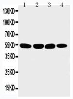 MATN3 Polyclonal Antibody