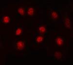 MAX Antibody in Immunocytochemistry (ICC/IF)