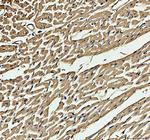 Myoglobin Antibody in Immunohistochemistry (Paraffin) (IHC (P))