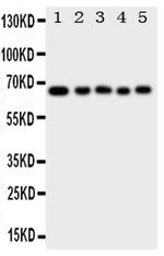 MBD4 Polyclonal Antibody