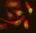 MCM3 Polyclonal Antibody