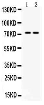 MDMX Antibody in Western Blot (WB)