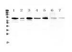 PCQAP Antibody in Western Blot (WB)