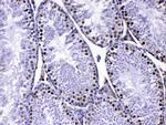 MED8 Antibody in Immunohistochemistry (Paraffin) (IHC (P))