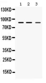 MEFV Polyclonal Antibody