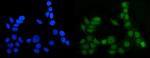 MGMT Polyclonal Antibody