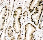 MGMT Antibody in Immunohistochemistry (Paraffin) (IHC (P))