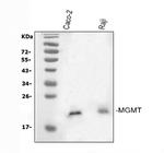MGMT Antibody in Western Blot (WB)