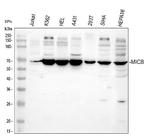 MICB Antibody in Western Blot (WB)