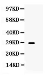 Aquaporin 0 Polyclonal Antibody
