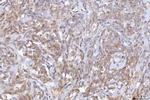 CD10 Antibody in Immunohistochemistry (Paraffin) (IHC (P))