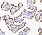 CD10 Antibody in Immunohistochemistry (Paraffin) (IHC (P))