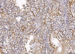 CD10 Polyclonal Antibody