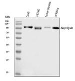 CD10 Antibody in Western Blot (WB)