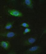 MMP10 Antibody in Immunocytochemistry (ICC/IF)