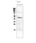 MMP10 Antibody in Western Blot (WB)