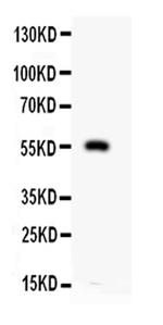 MMP12 Polyclonal Antibody