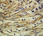 MMP16 Polyclonal Antibody