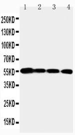 MMP24 Polyclonal Antibody