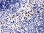 MMP8 Polyclonal Antibody
